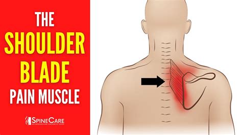 The Shoulder Blade Pain Muscle How To Release It For Instant Relief