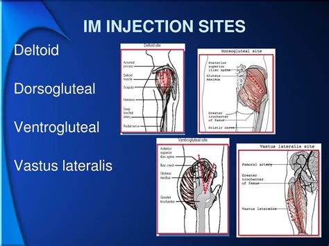 The Ultimate Guide To Im Injection Sites Diagrams