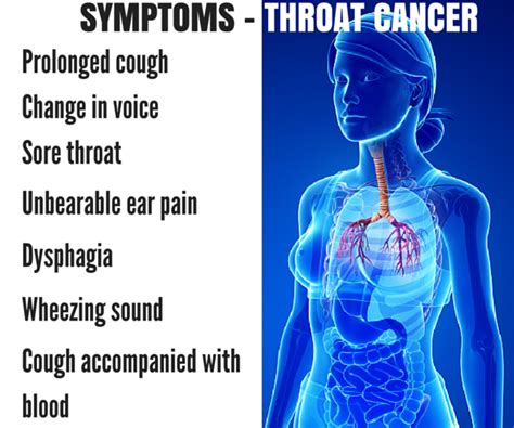 Throat Cancer Causes Signs Symptoms Survival Rate Treatment