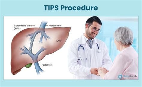 Tips Procedure Steps Video Survival Rate And Side Effects