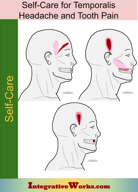 Tooth Pain And Headache
