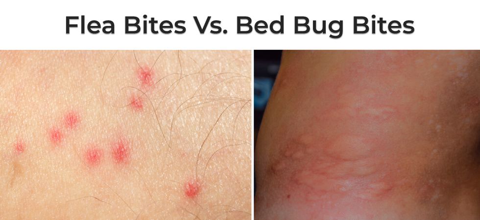 Top 102 Pictures Pictures Of Flea Bites And Bed Bug Bites Sharp
