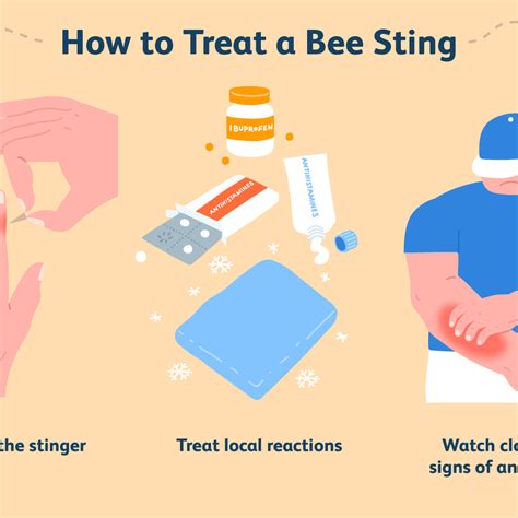 Treatment For Yellow Jacket Sting Parents Republic