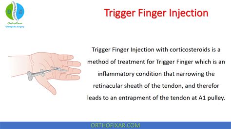Trigger Finger Injections