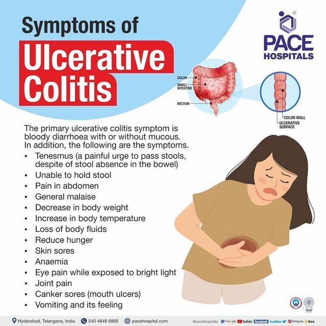 Ulcerative Colitis Symptoms Causes Types And Complications