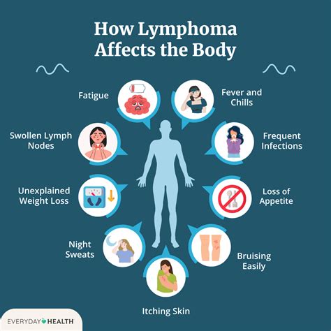 Understanding B Cell Lymphoma Types Symptoms Diagnosis And Treatment