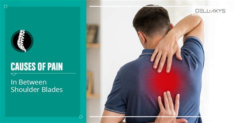 Upper Back Pain Between Shoulder Blades Causes Of Pain Between The