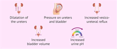 Urinary Tract Infection During Pregnancy Causes Symptoms Diagnosis