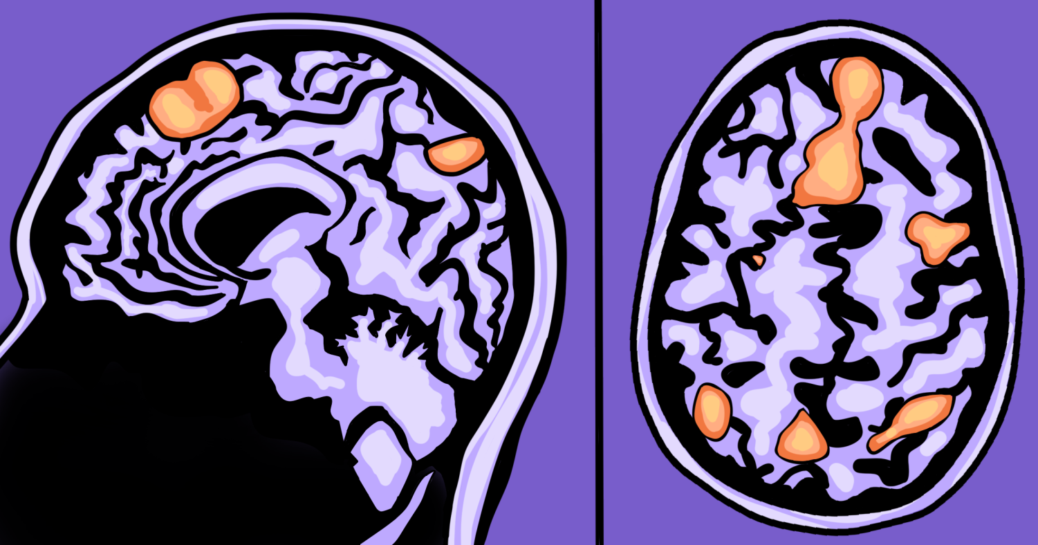 Ut Researchers Studying Intersection Of Trauma Genetics In Development