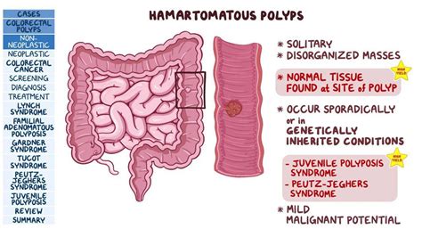 Video Colorectal Polyps And Cancer Pathology Review