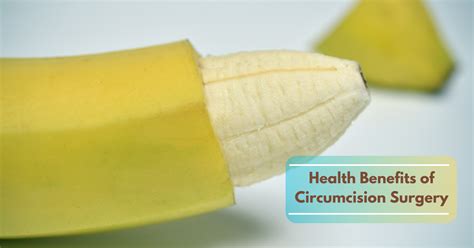 What Are The 5 Health Benefits Of Circumcision Surgery Sri