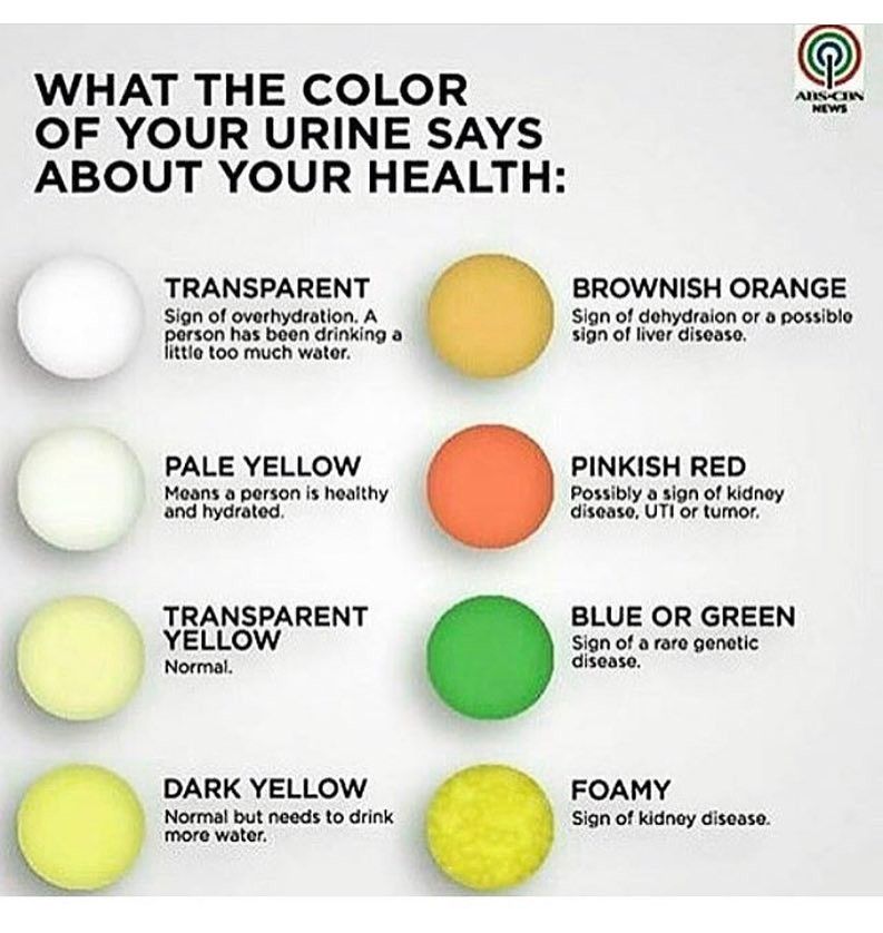 What Does Baby Poop Color Mean Chart And Guide