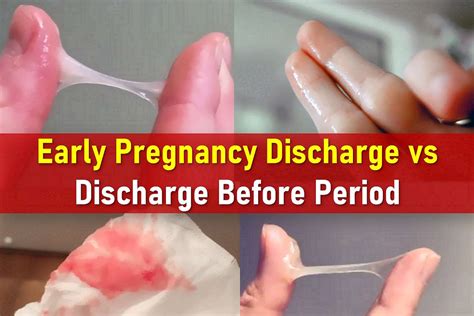 What Does Discharge Look Like Before Your Period