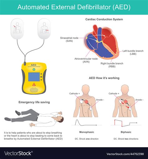 What Is An Automated External Defibrillator How To Use Them Medshop