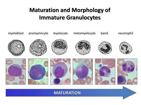 What Is Immature Granulocytes
