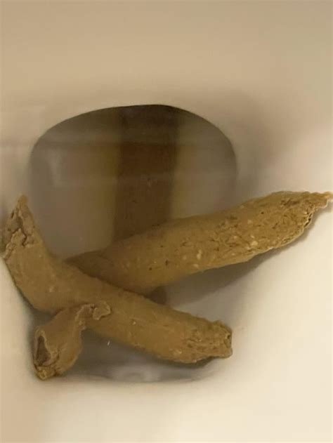 What Is The White Spots R Poop