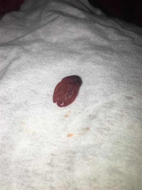 What The Hell Is This I M On My Period And It Just Came Out Of Me No