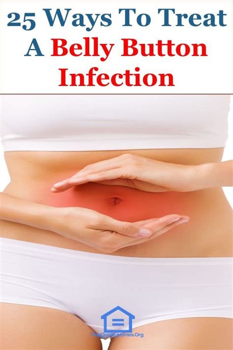 Yeast Infection Belly Button